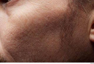 HD Face Skin Chase cheek face skin pores skin texture…